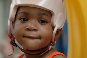 Young boy wearing special medical helmet
